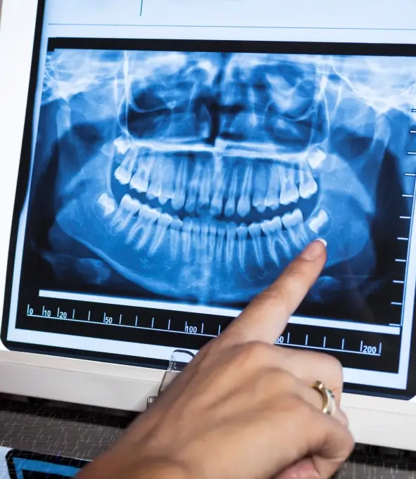 digital radiography in hagerstown