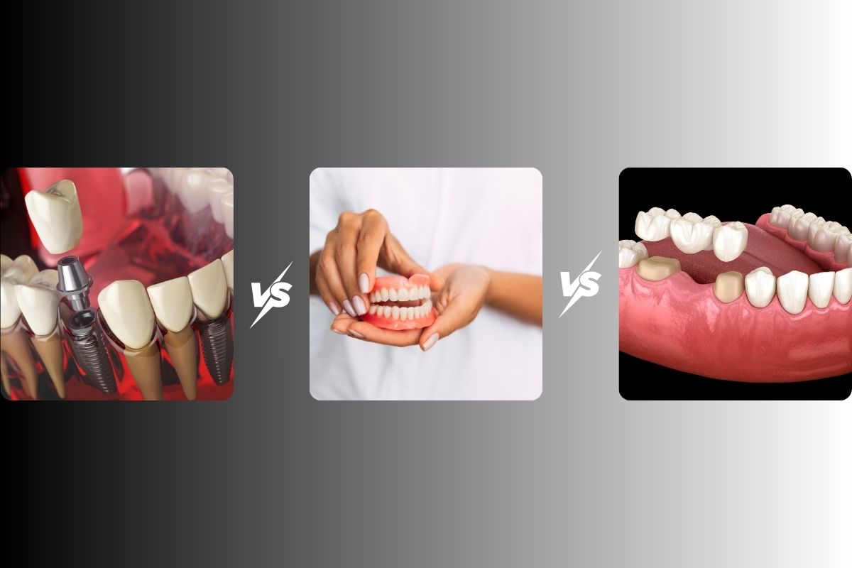 dental implants vs bridges vs dentures